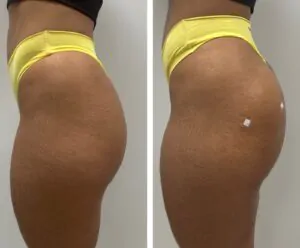 WhatsApp Image 2023-08-22 at 15.18.18