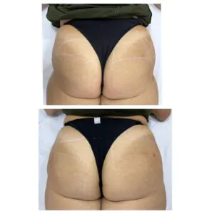 WhatsApp Image 2023-08-22 at 15.26.59 (1)