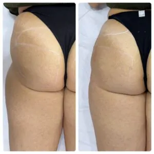 WhatsApp Image 2023-08-22 at 15.27.00